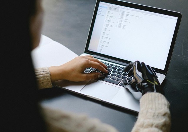 Woman using laptop with prosthetic right hand